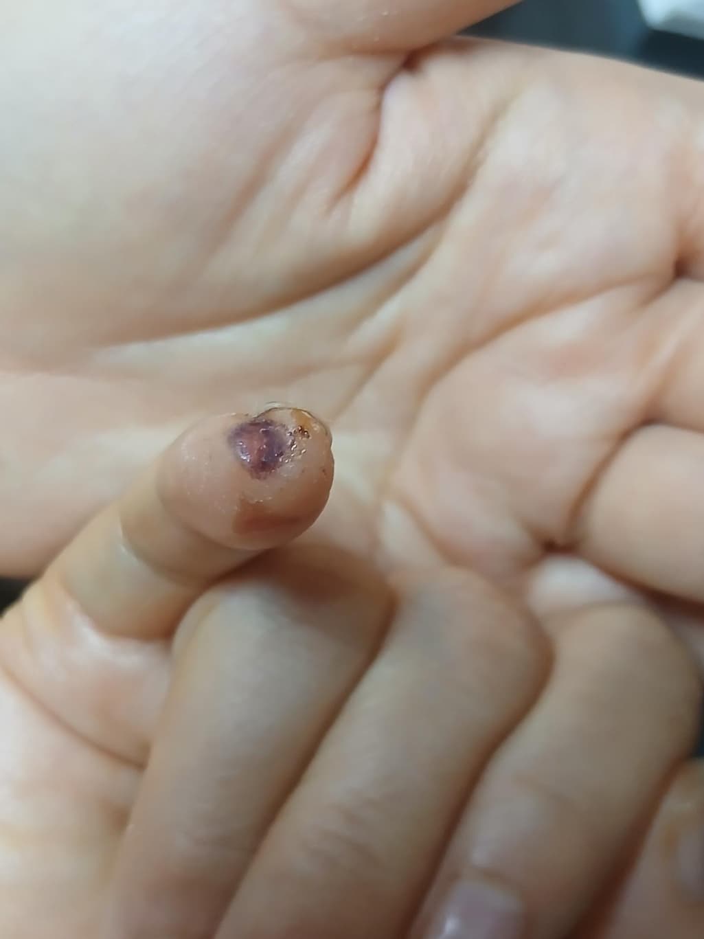 2번 째 사진