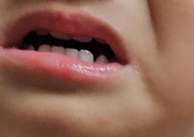 2번 째 사진