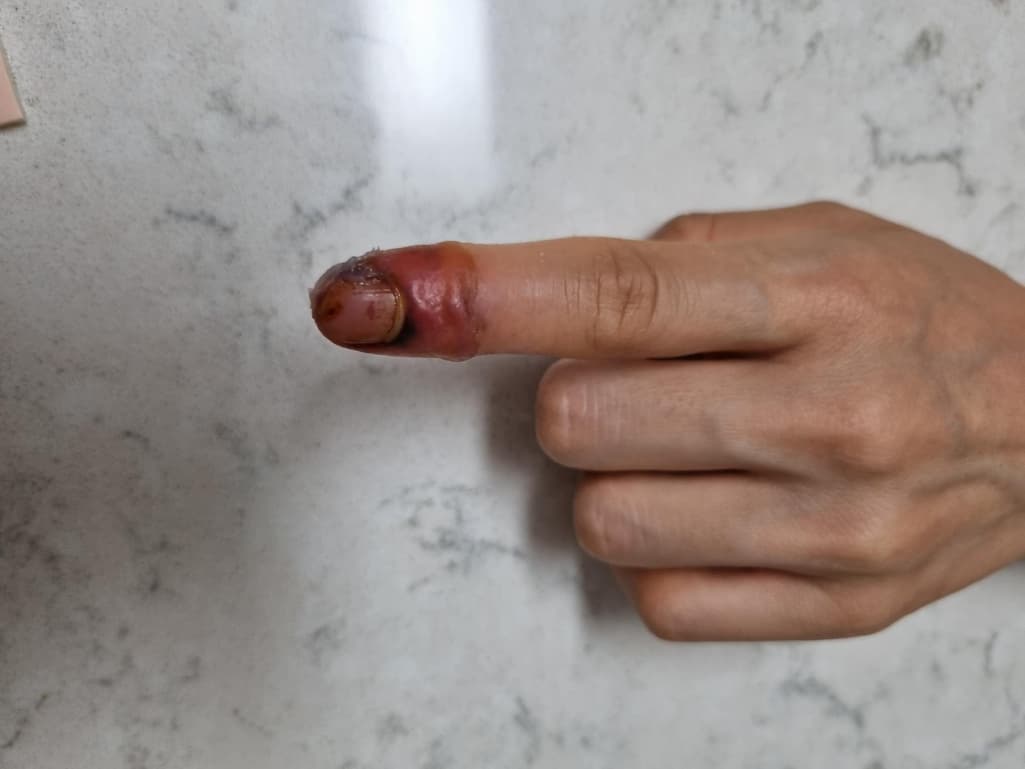 2번 째 사진