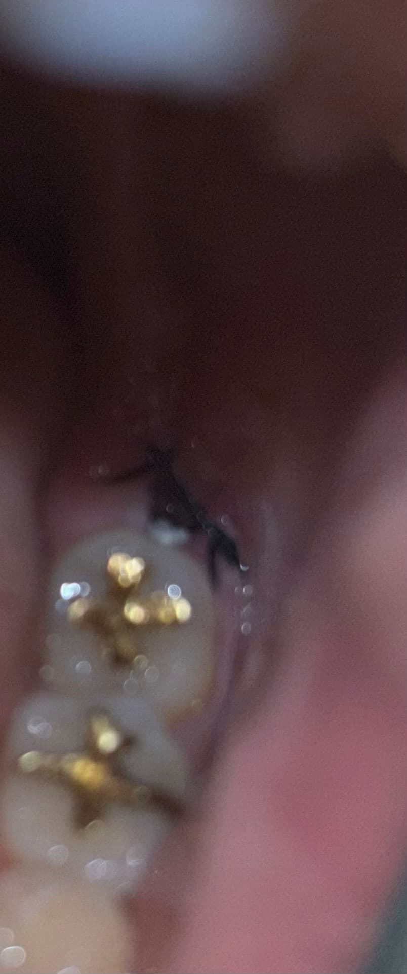 2번 째 사진