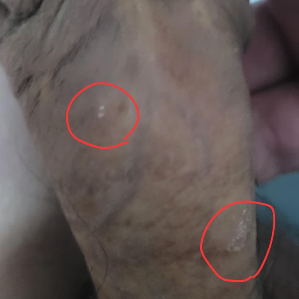 2번 째 사진