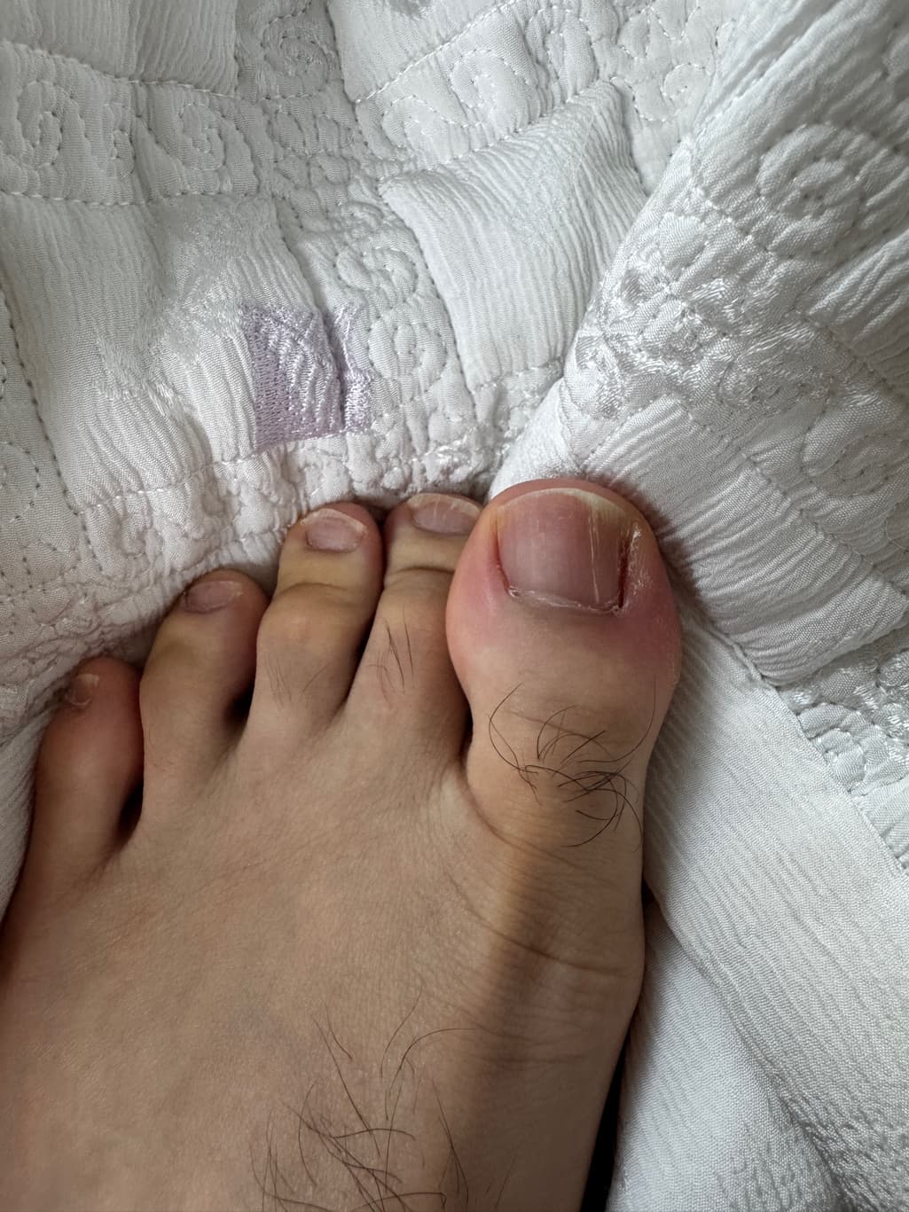 3번 째 사진