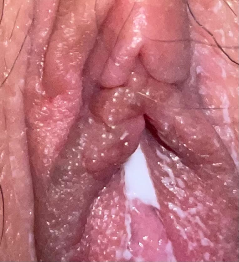 2번 째 사진