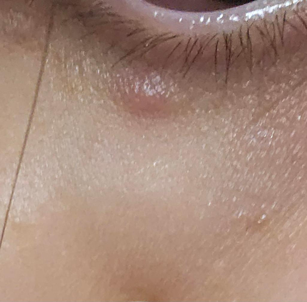 3번 째 사진