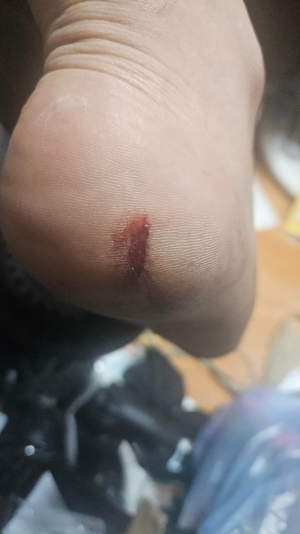 1번 째 사진
