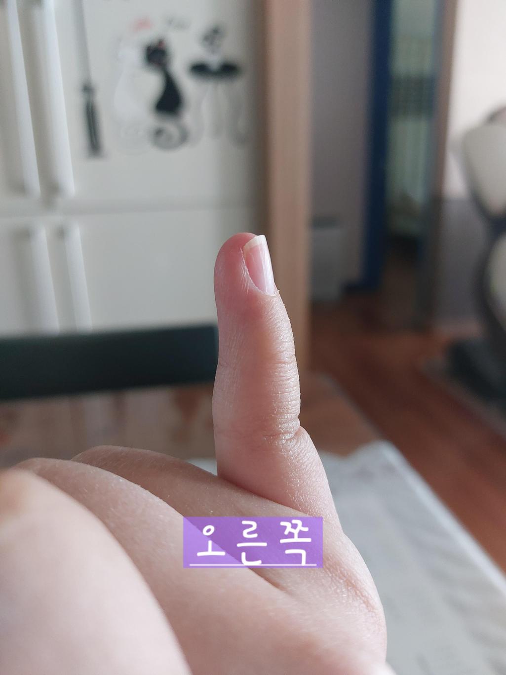 2번 째 사진