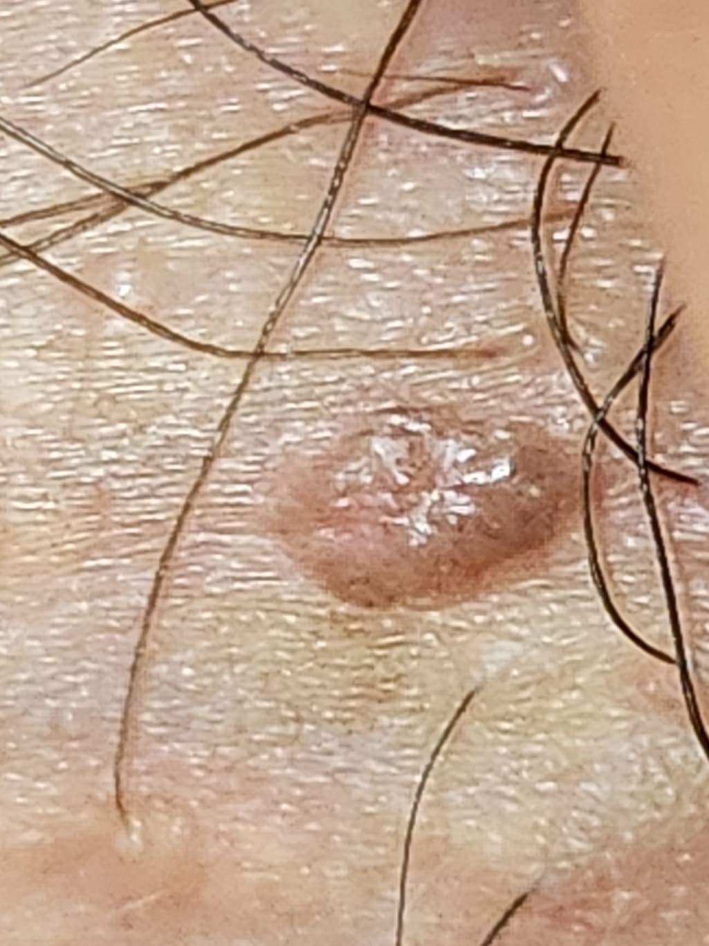 3번 째 사진