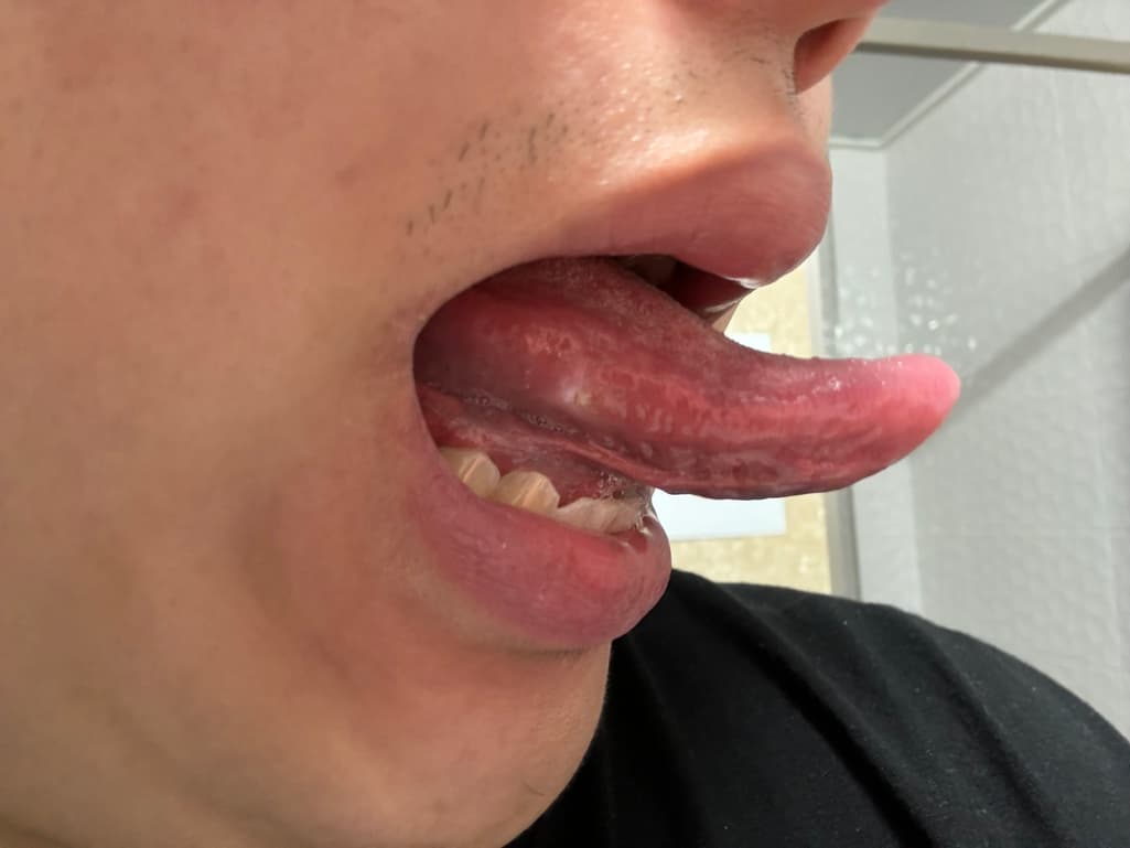 2번 째 사진