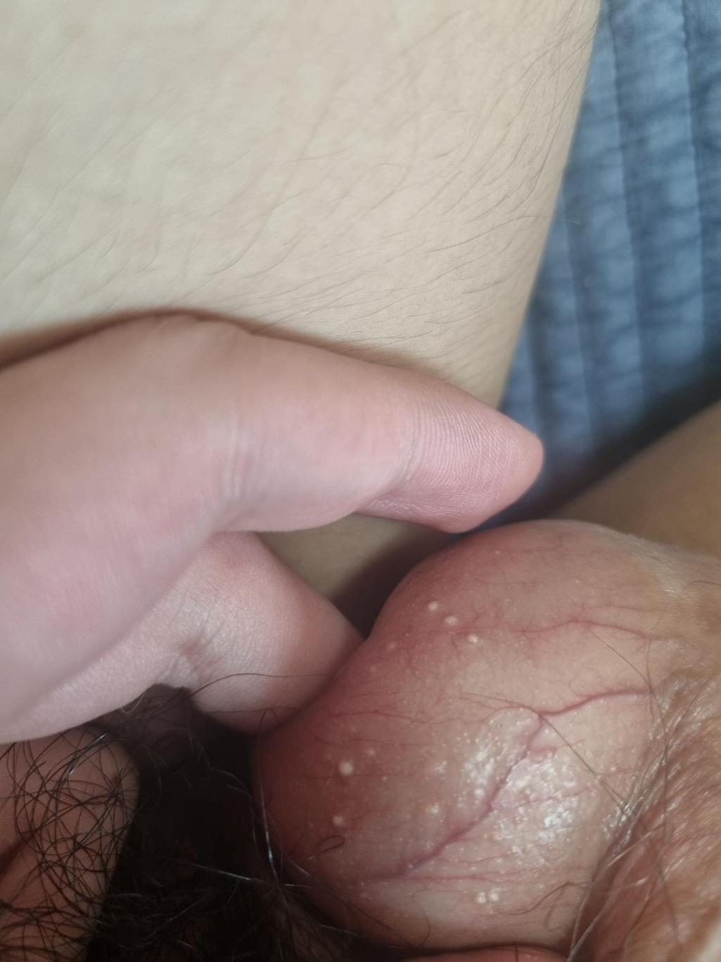 2번 째 사진