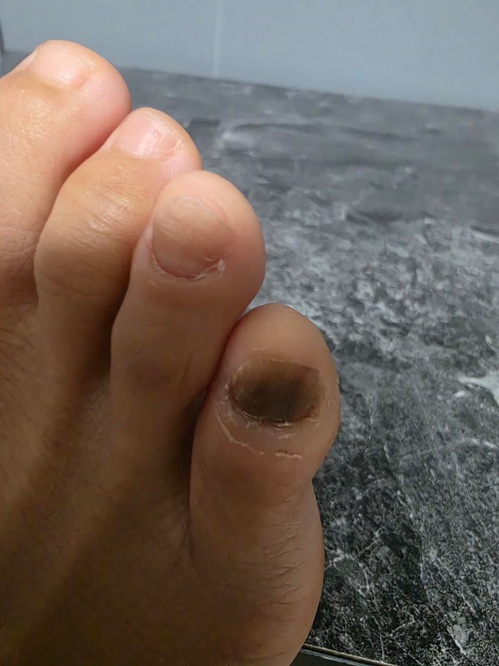 2번 째 사진