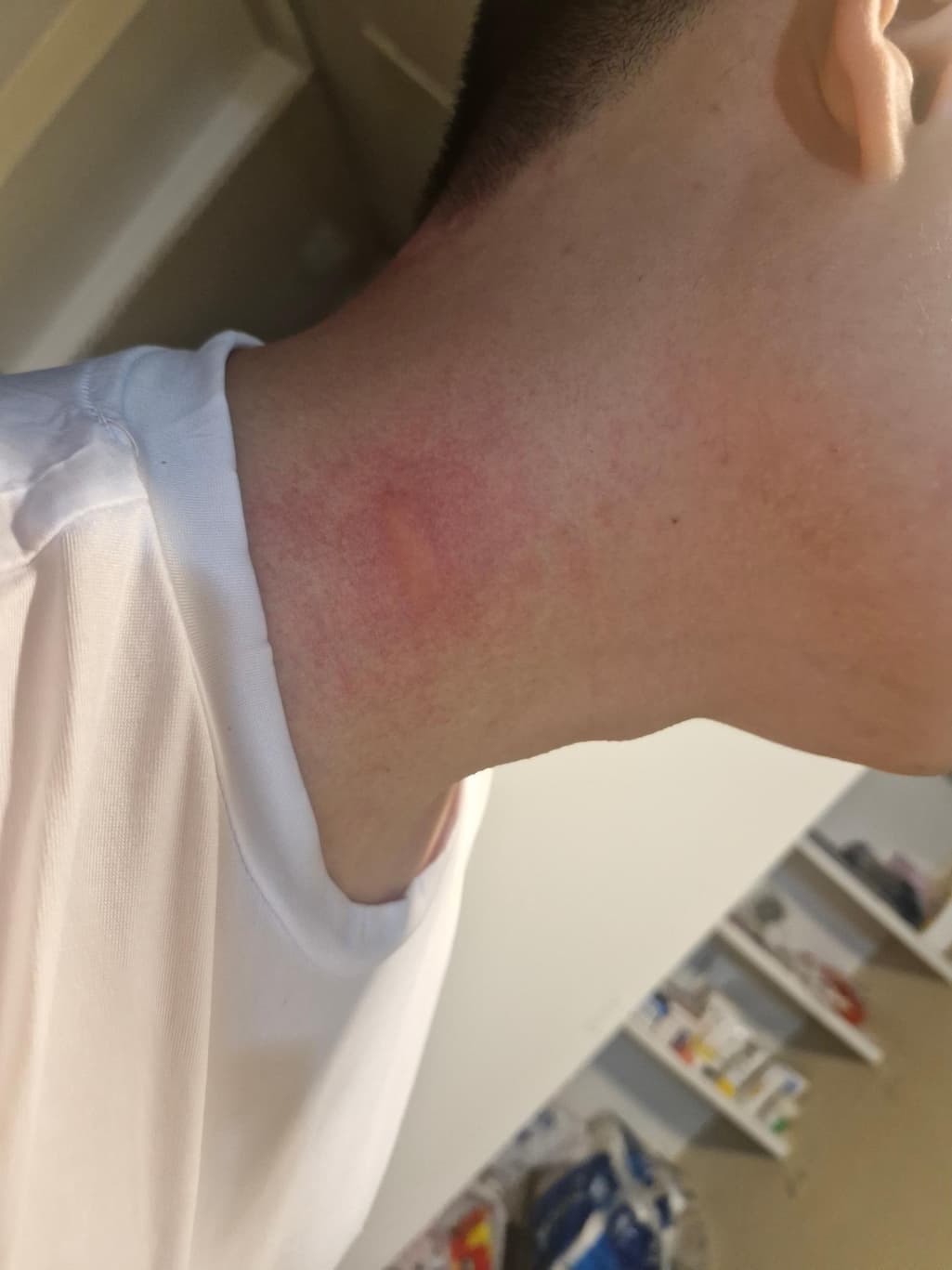 2번 째 사진