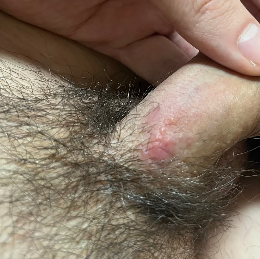 2번 째 사진