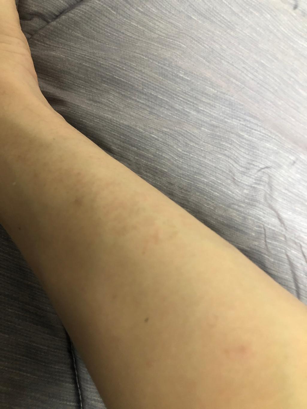 2번 째 사진