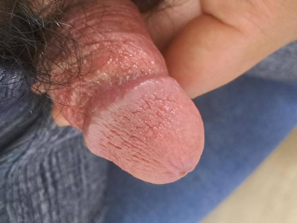 3번 째 사진