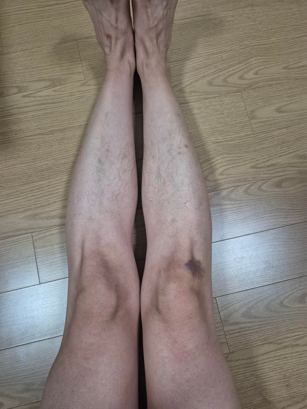1번 째 사진