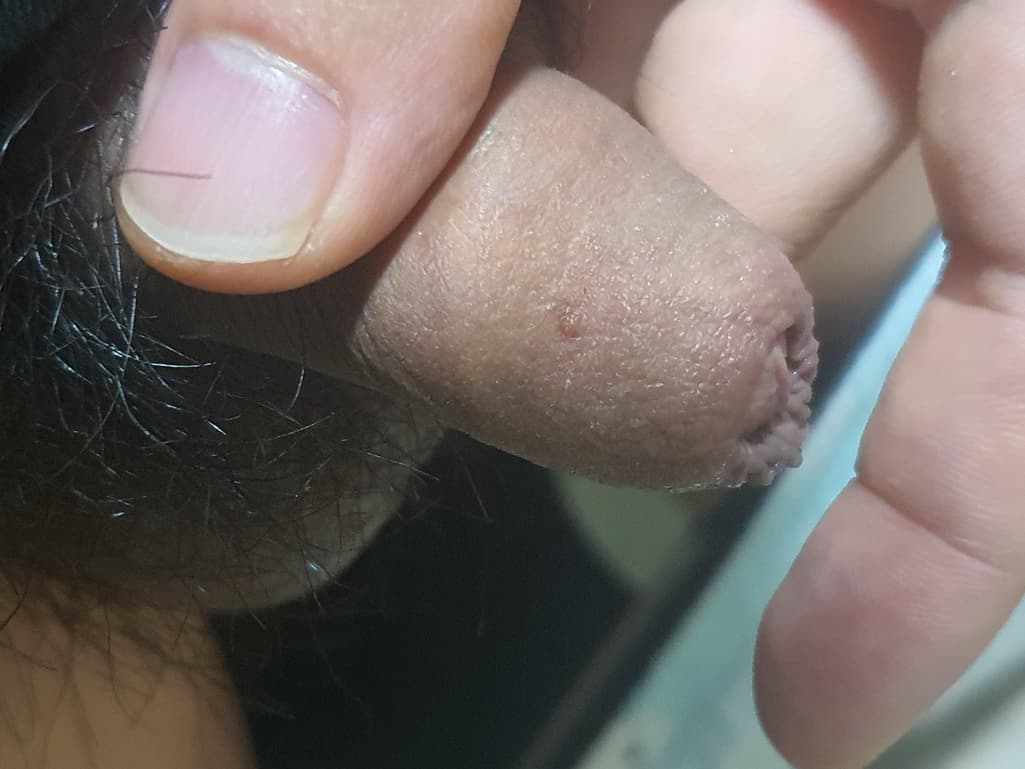3번 째 사진