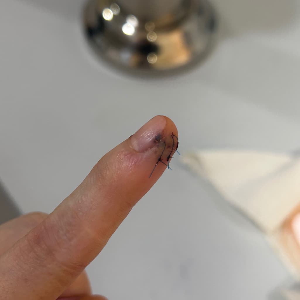2번 째 사진