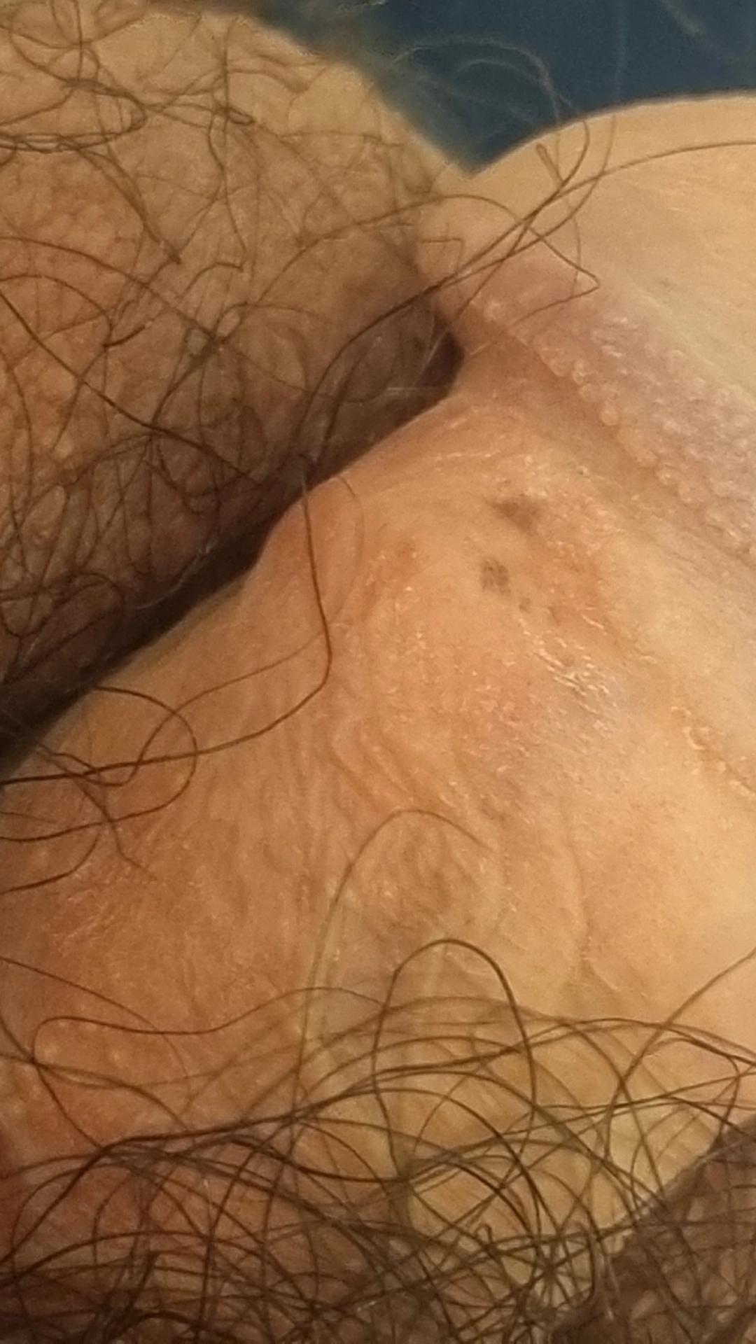 2번 째 사진