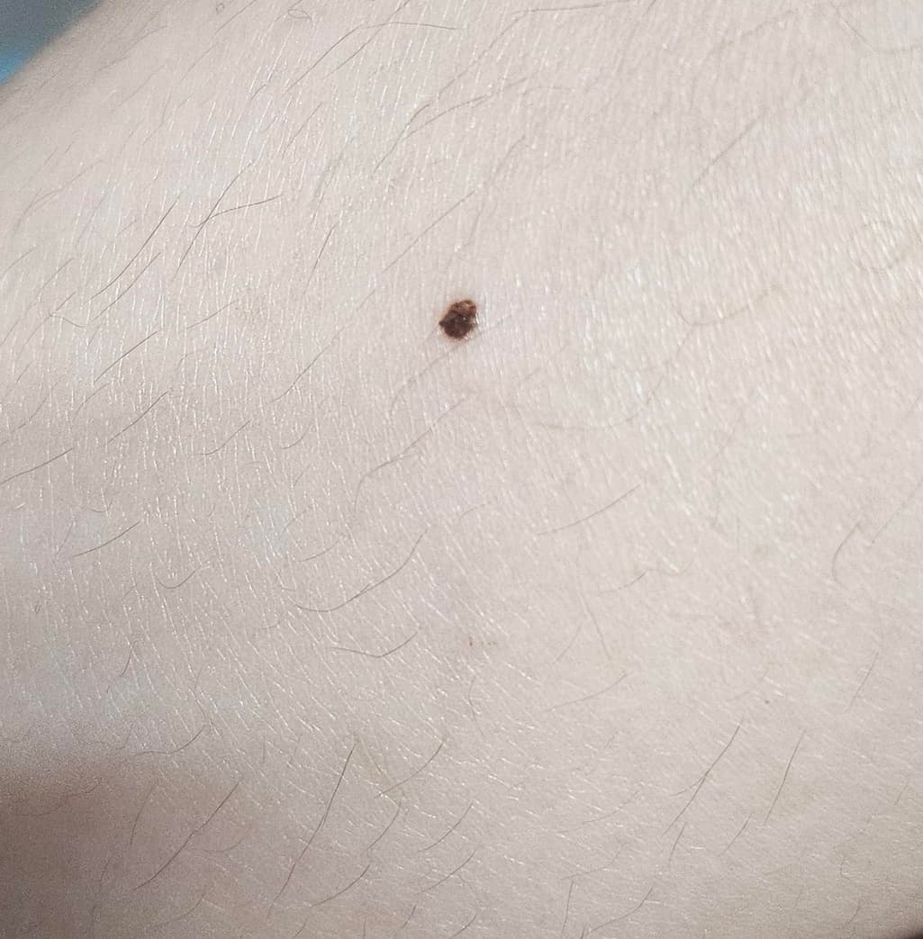 2번 째 사진
