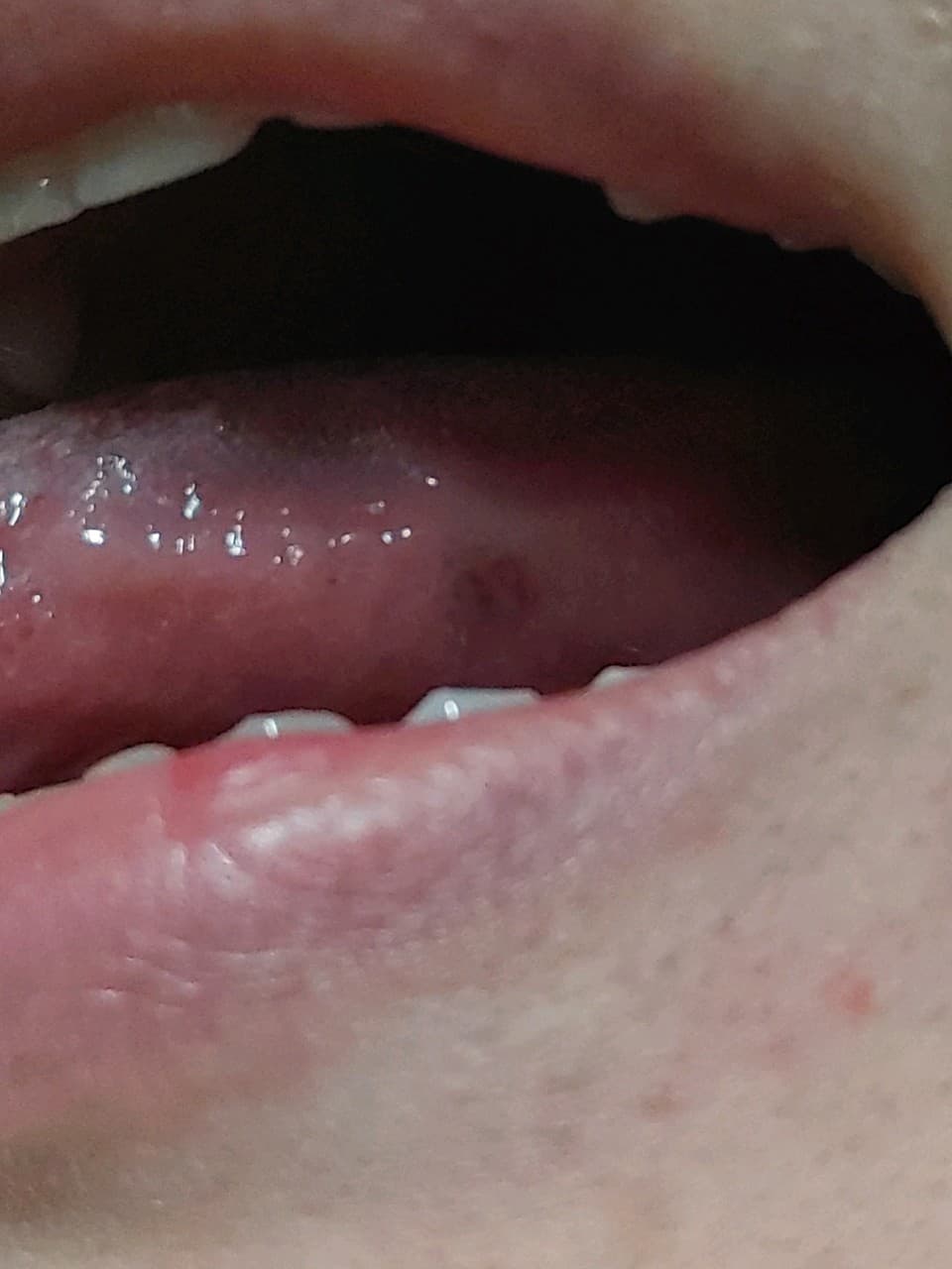 2번 째 사진
