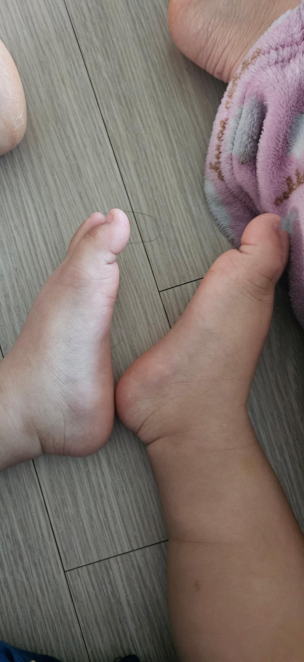 2번 째 사진