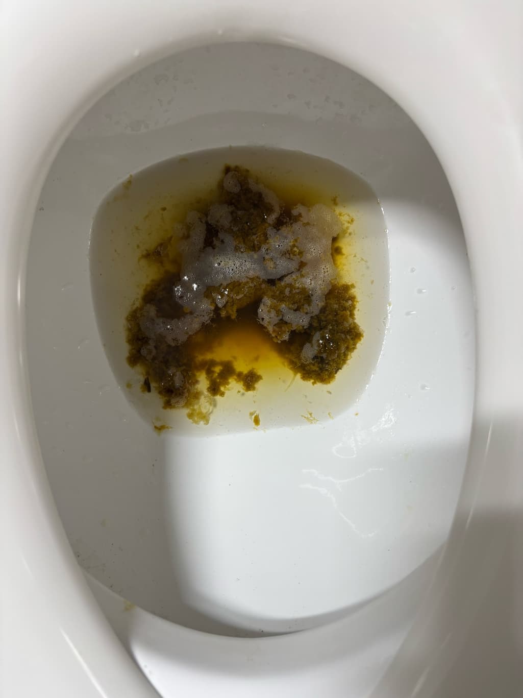 2번 째 사진