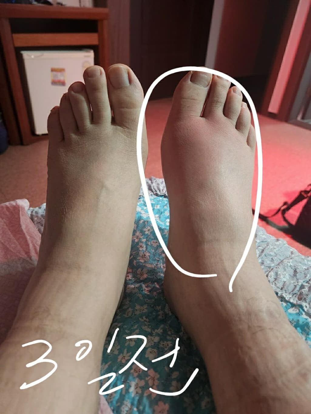 2번 째 사진