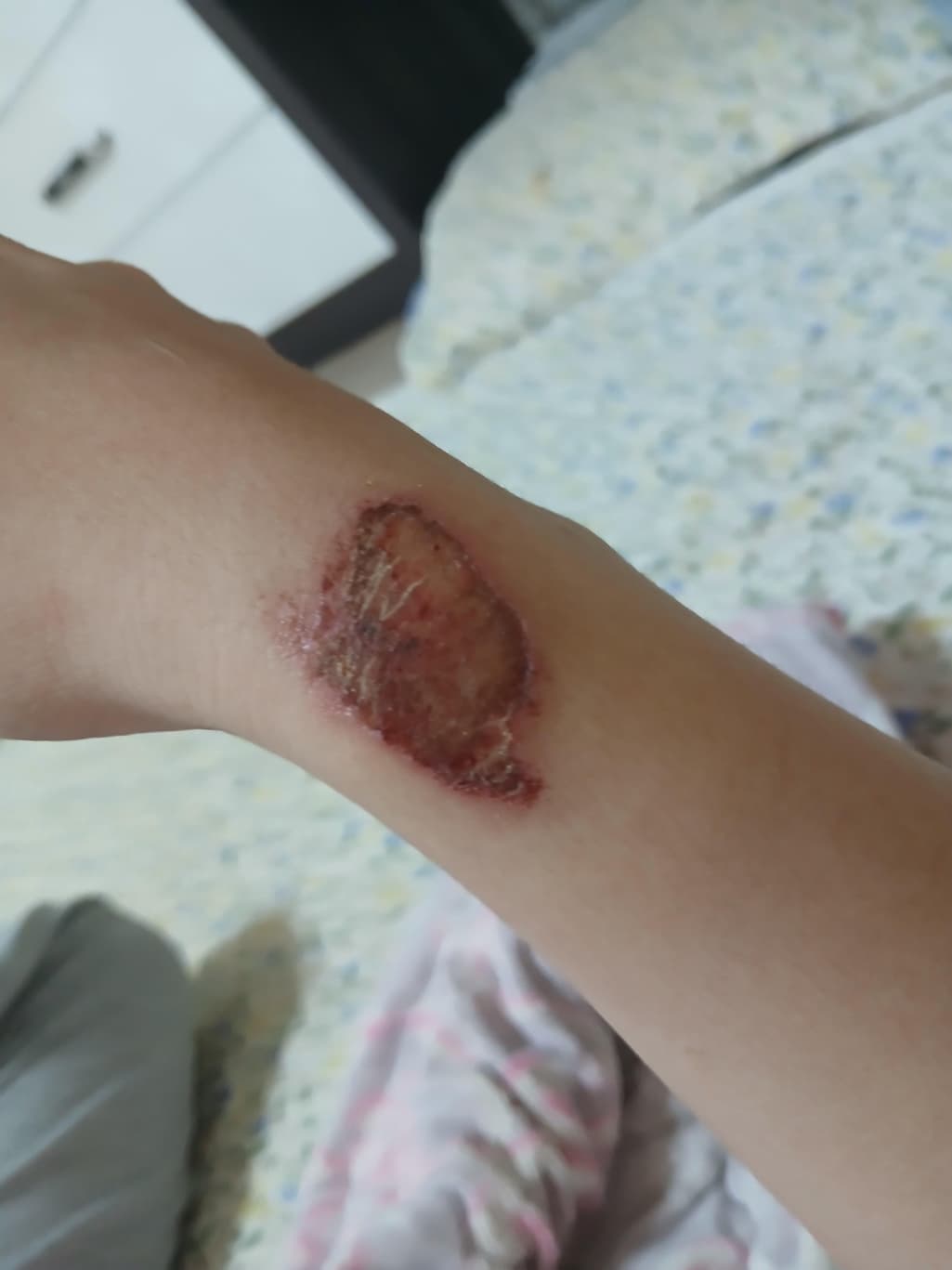 2번 째 사진