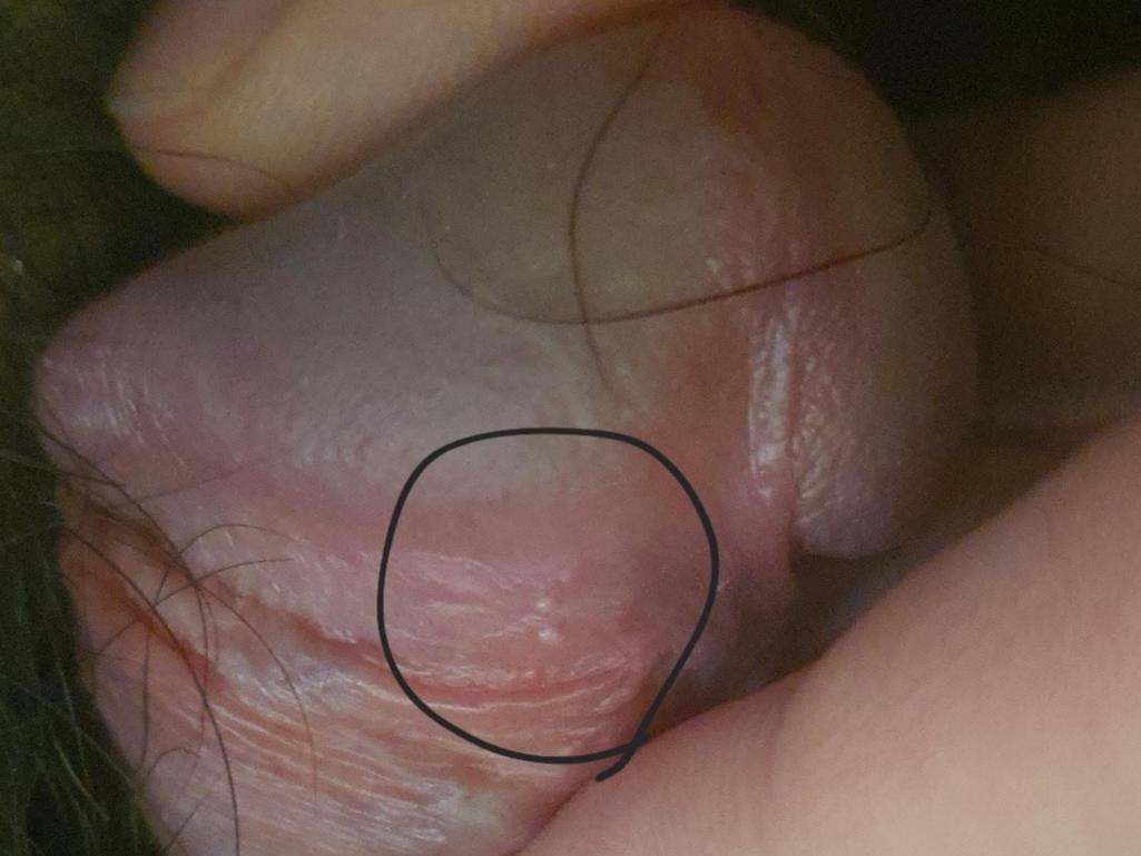 2번 째 사진