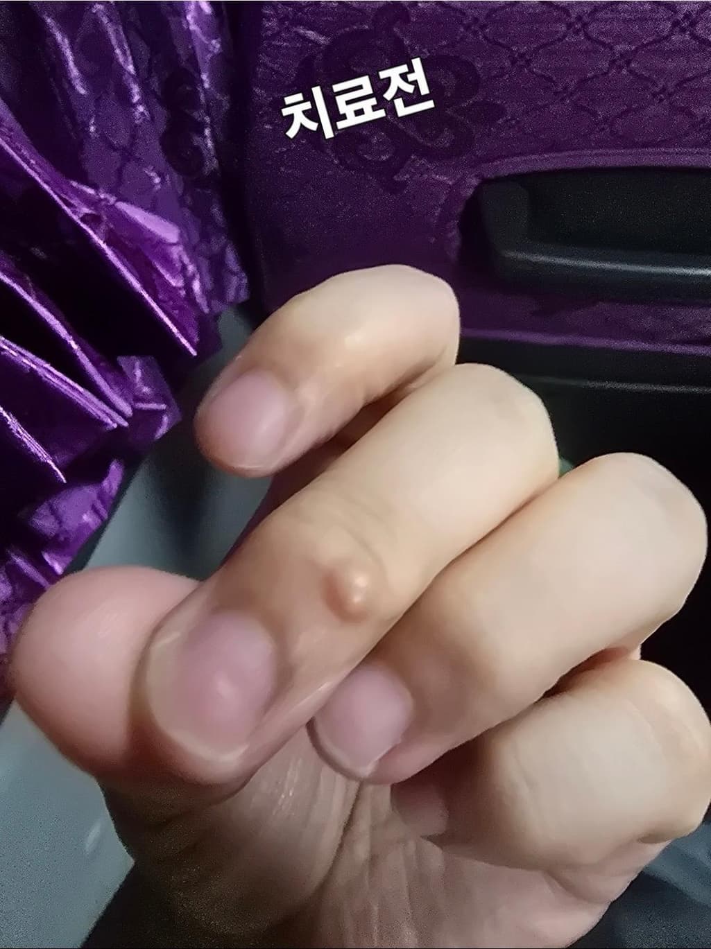 2번 째 사진