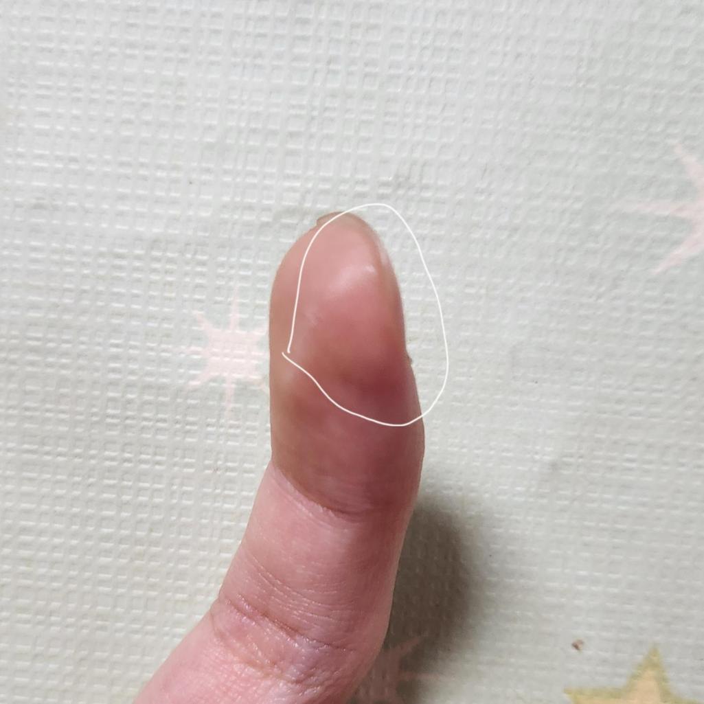 2번 째 사진