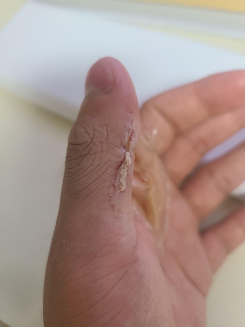 2번 째 사진