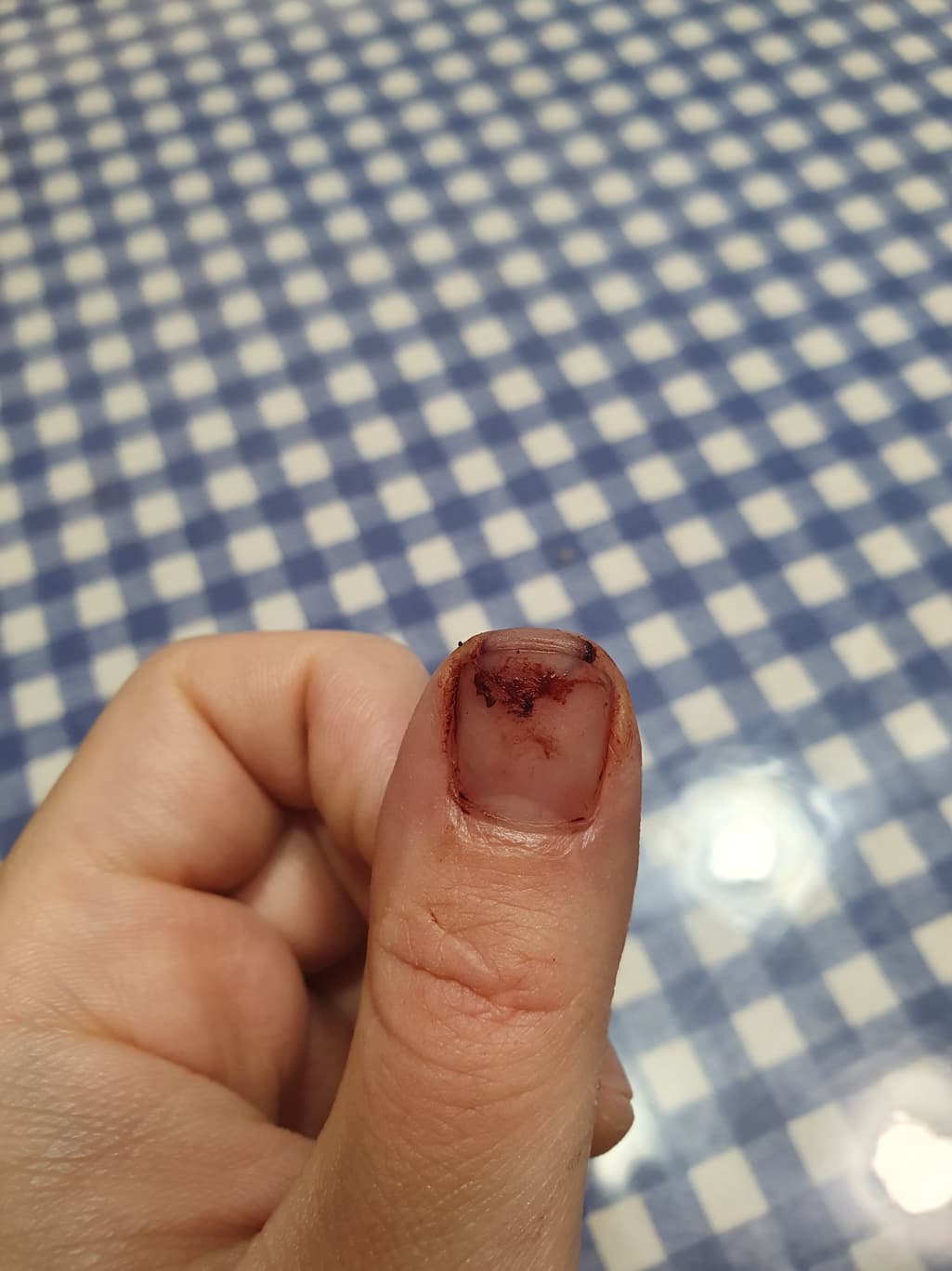 2번 째 사진