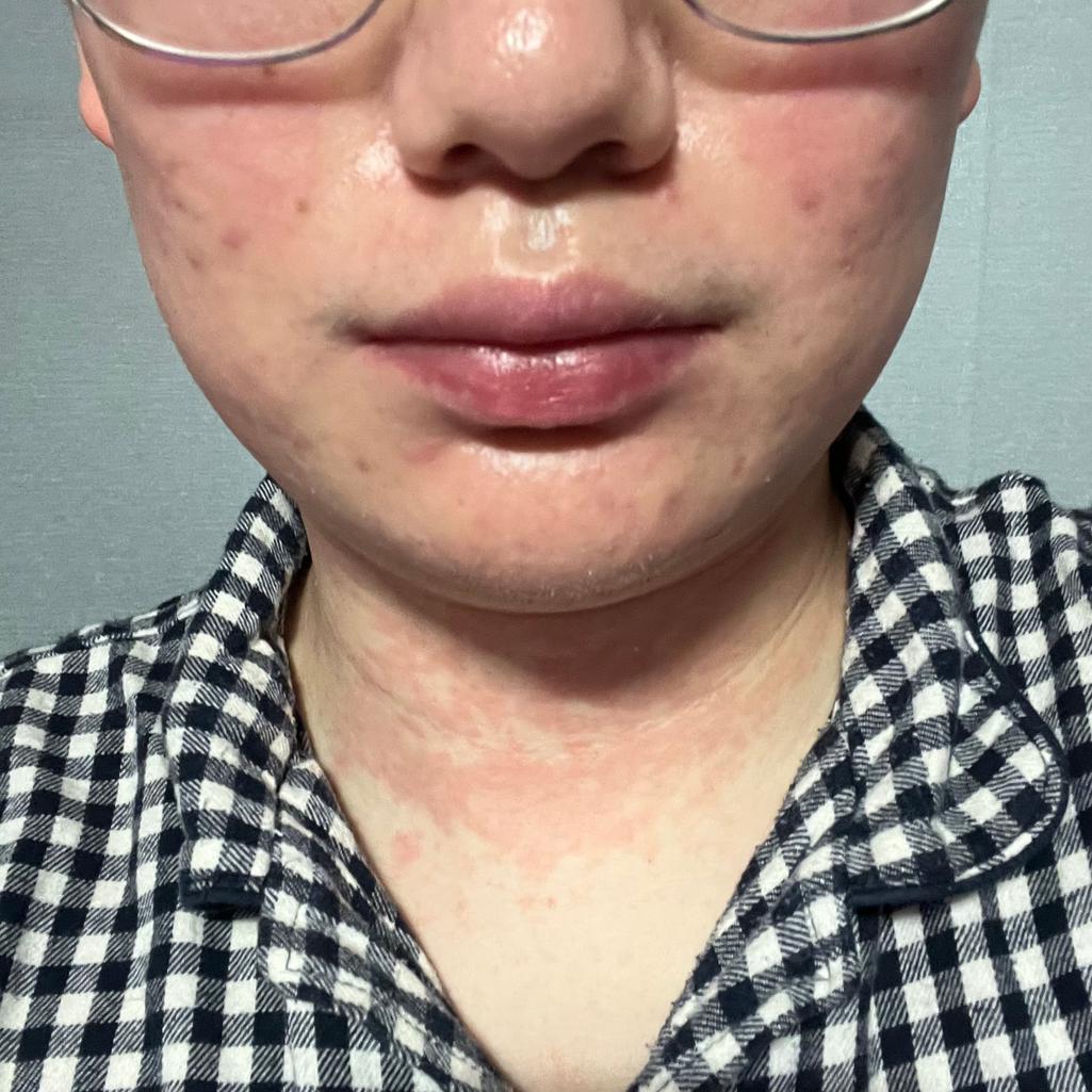 2번 째 사진
