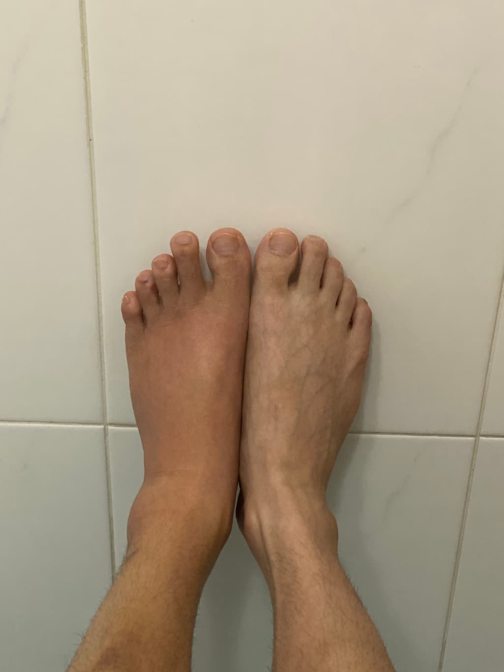 3번 째 사진