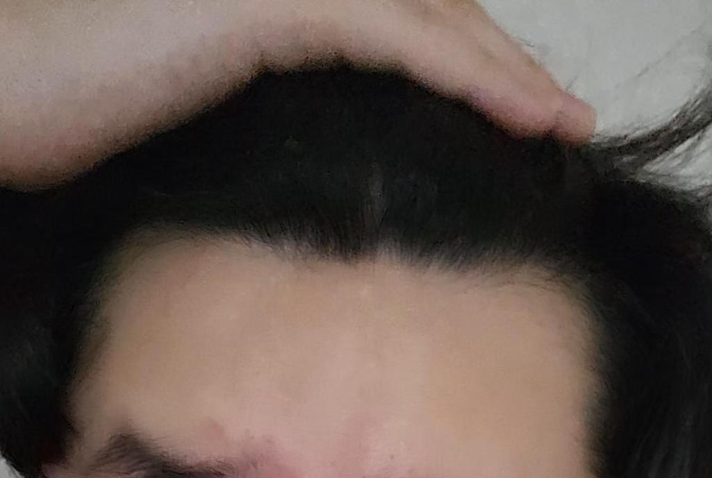 2번 째 사진