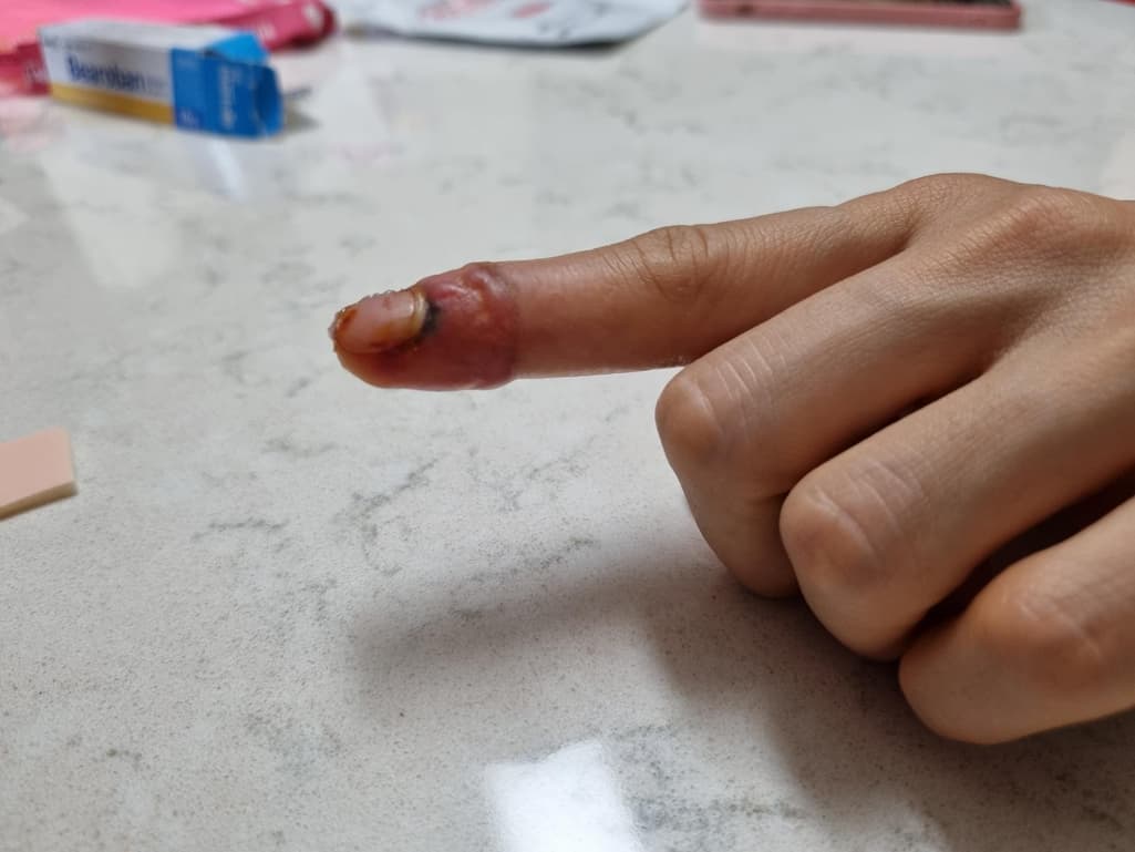 3번 째 사진