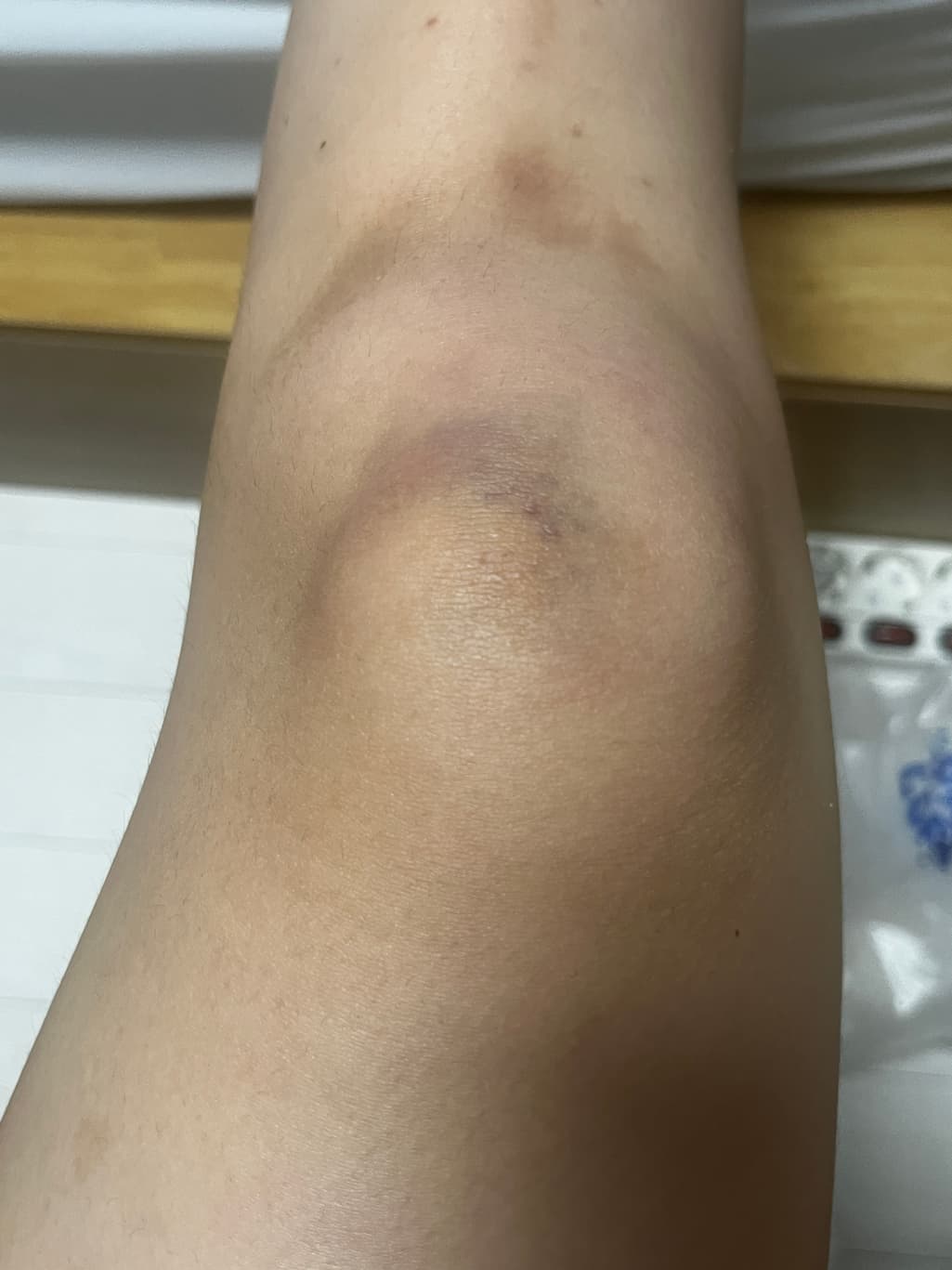 3번 째 사진