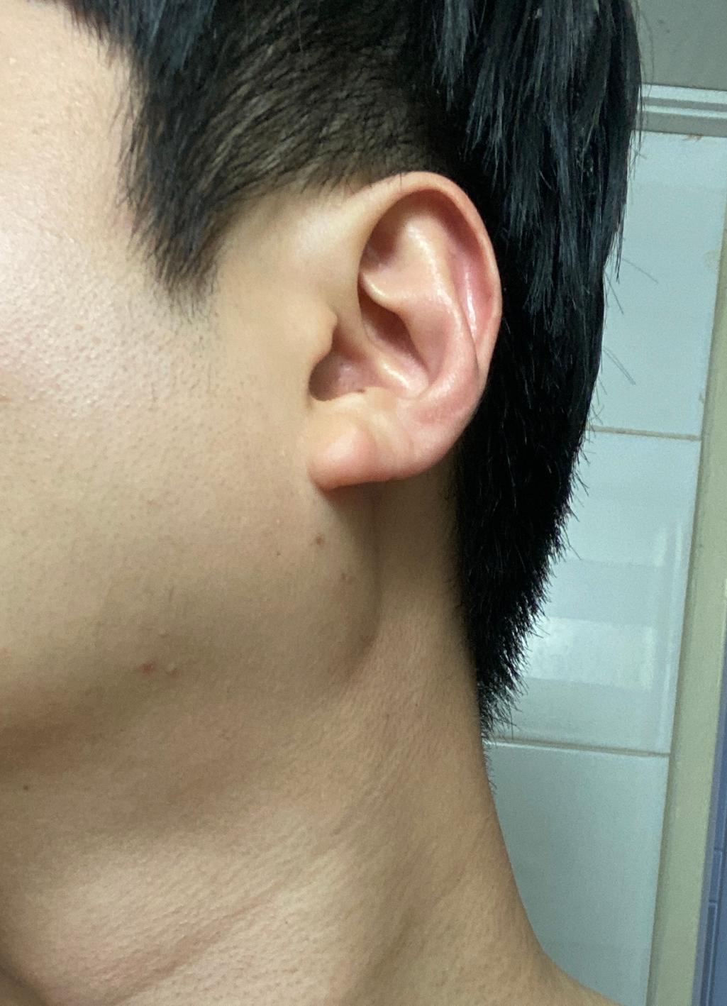 2번 째 사진