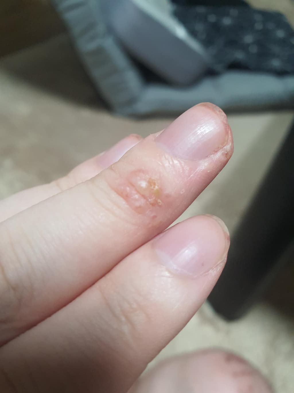 3번 째 사진