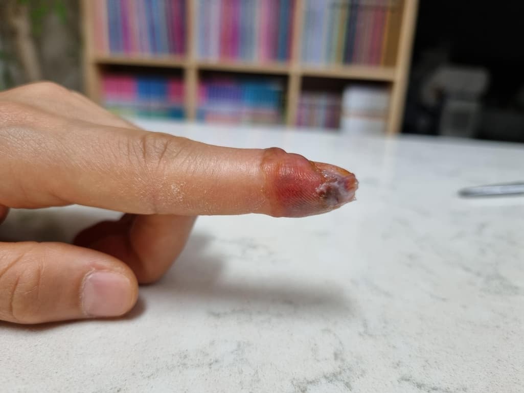 1번 째 사진