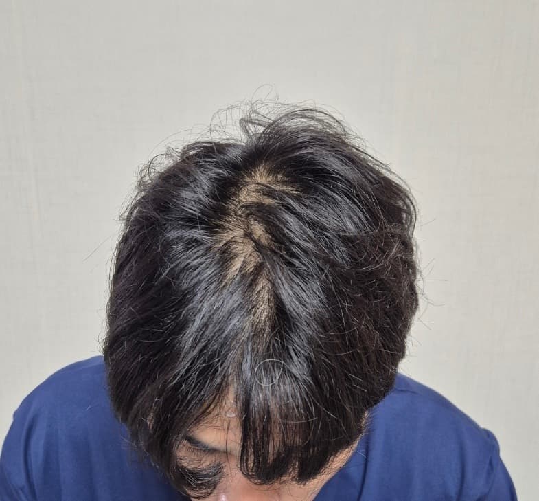 1번 째 사진