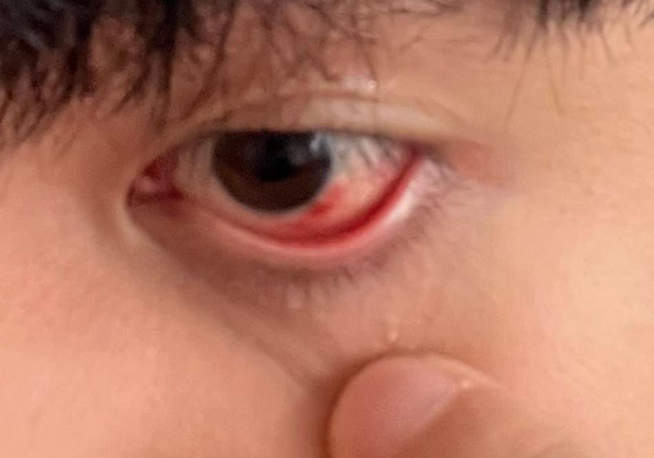 1번 째 사진