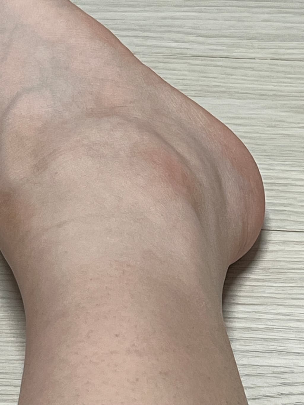 3번 째 사진