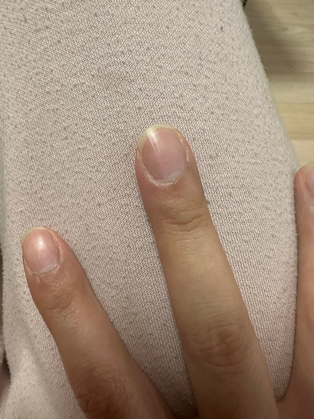 2번 째 사진