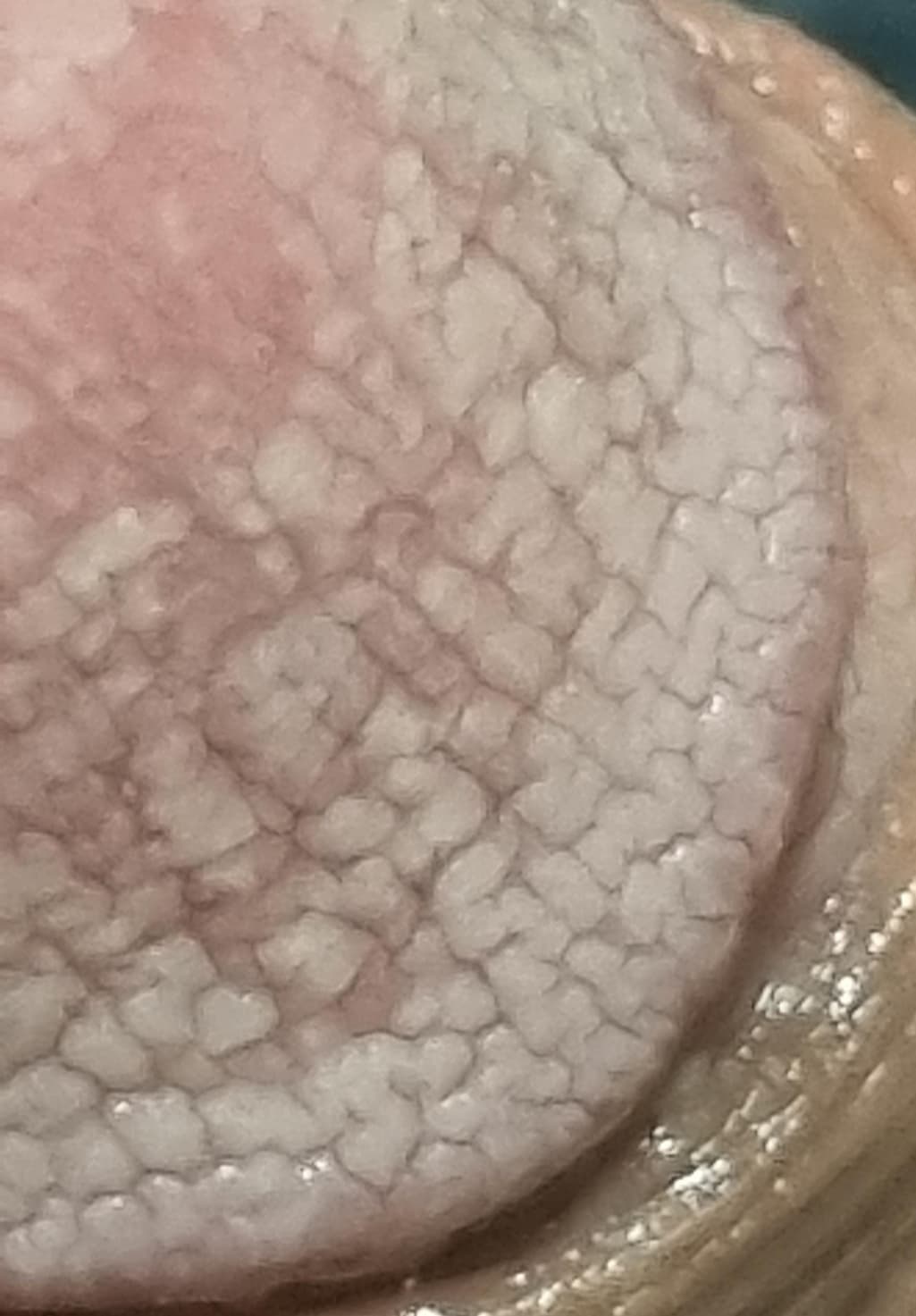 2번 째 사진