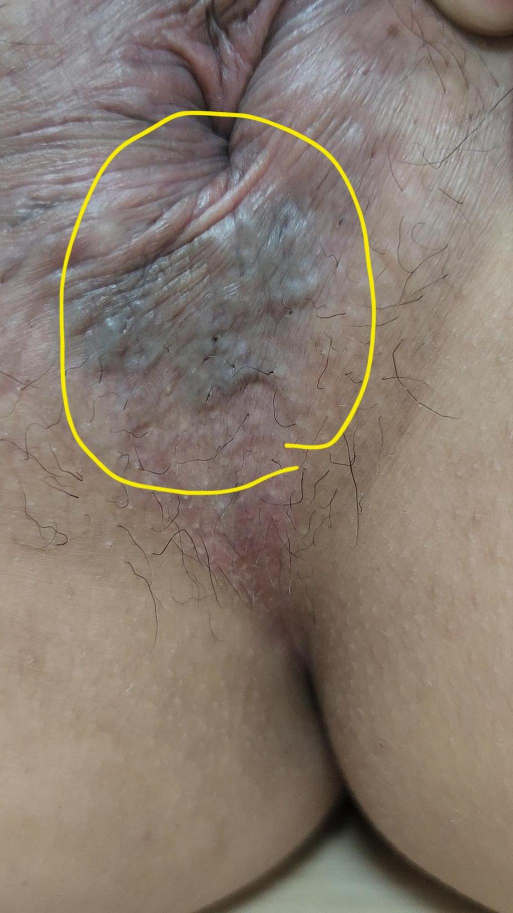 3번 째 사진