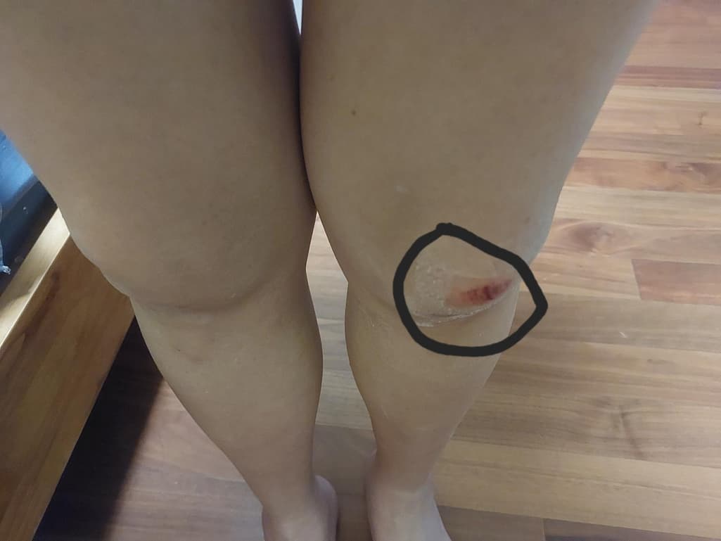 2번 째 사진
