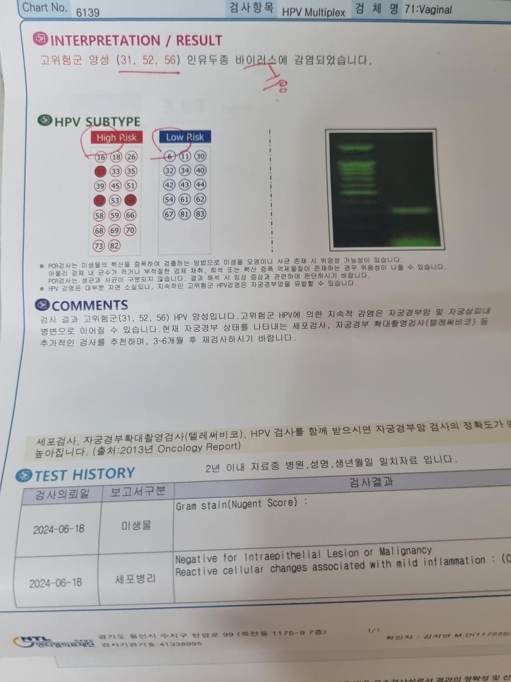 2번 째 사진