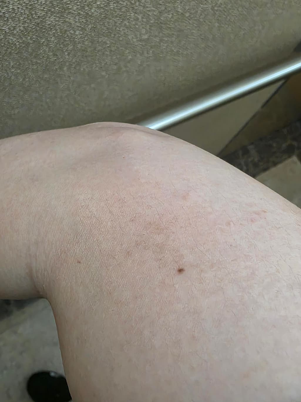 2번 째 사진